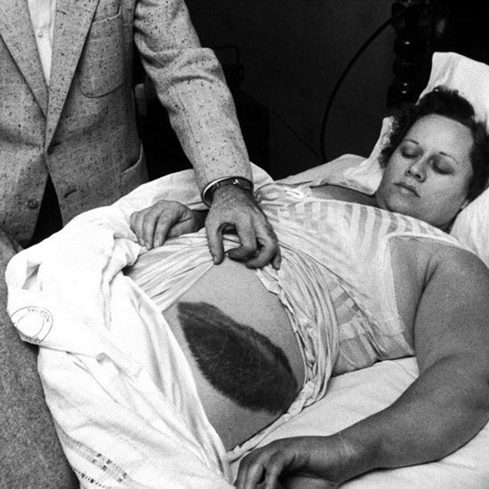 Ann Hodges of Sylacauga, struck by meteor. Life Magazine Alabama News