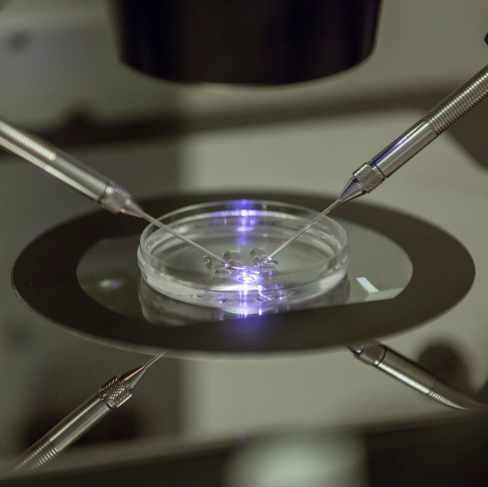 IVF, in-vitro Alabama News