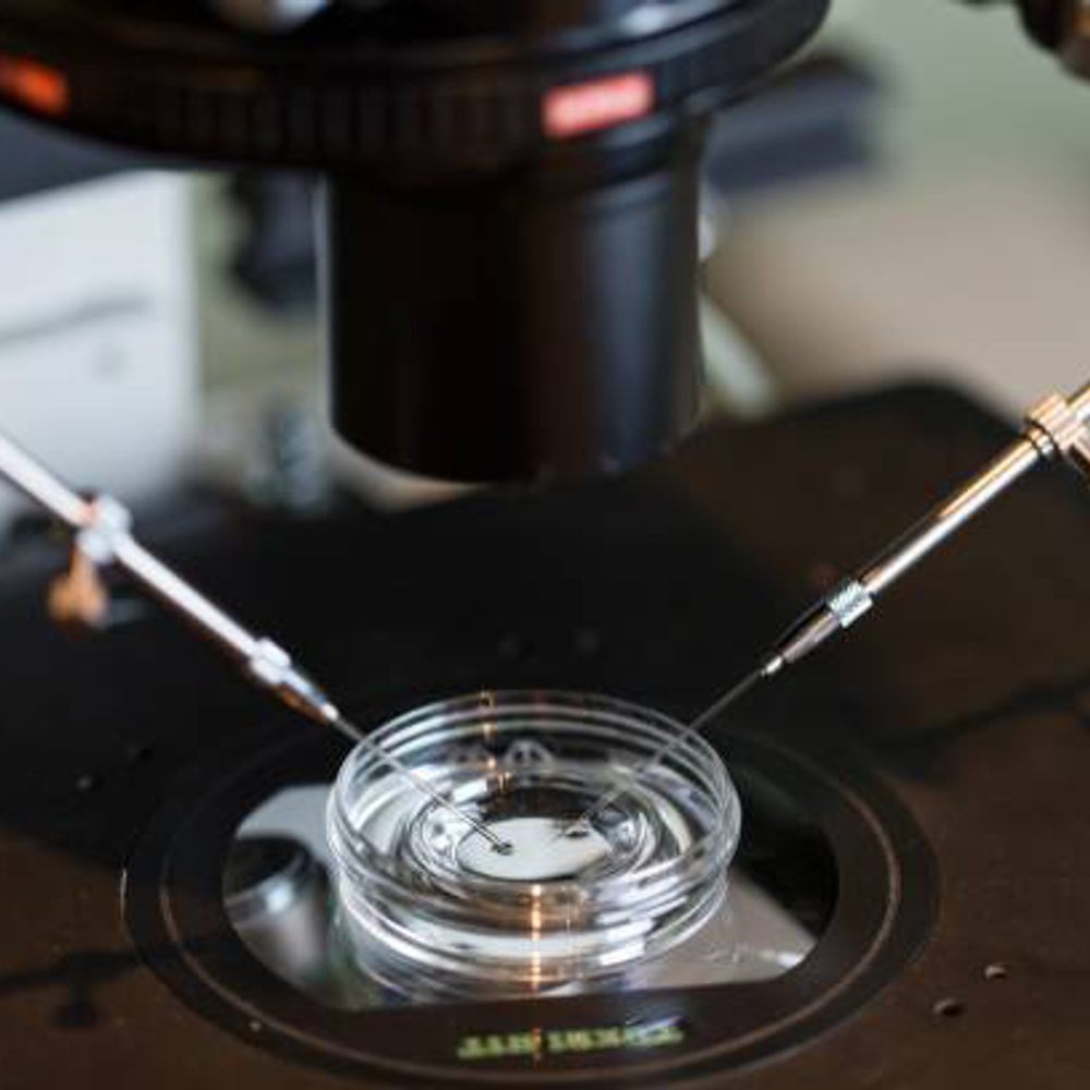 IVF, in-vitro Alabama News