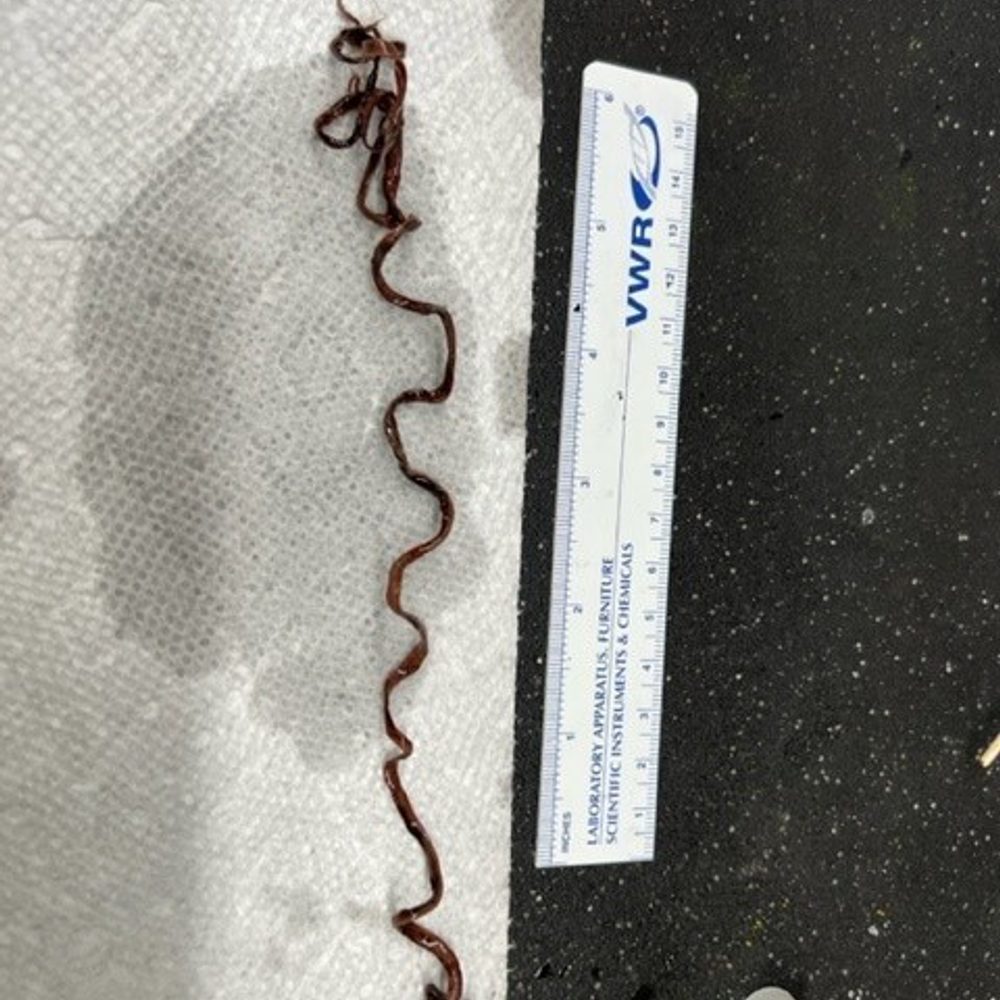 Clot 2 Alabama News