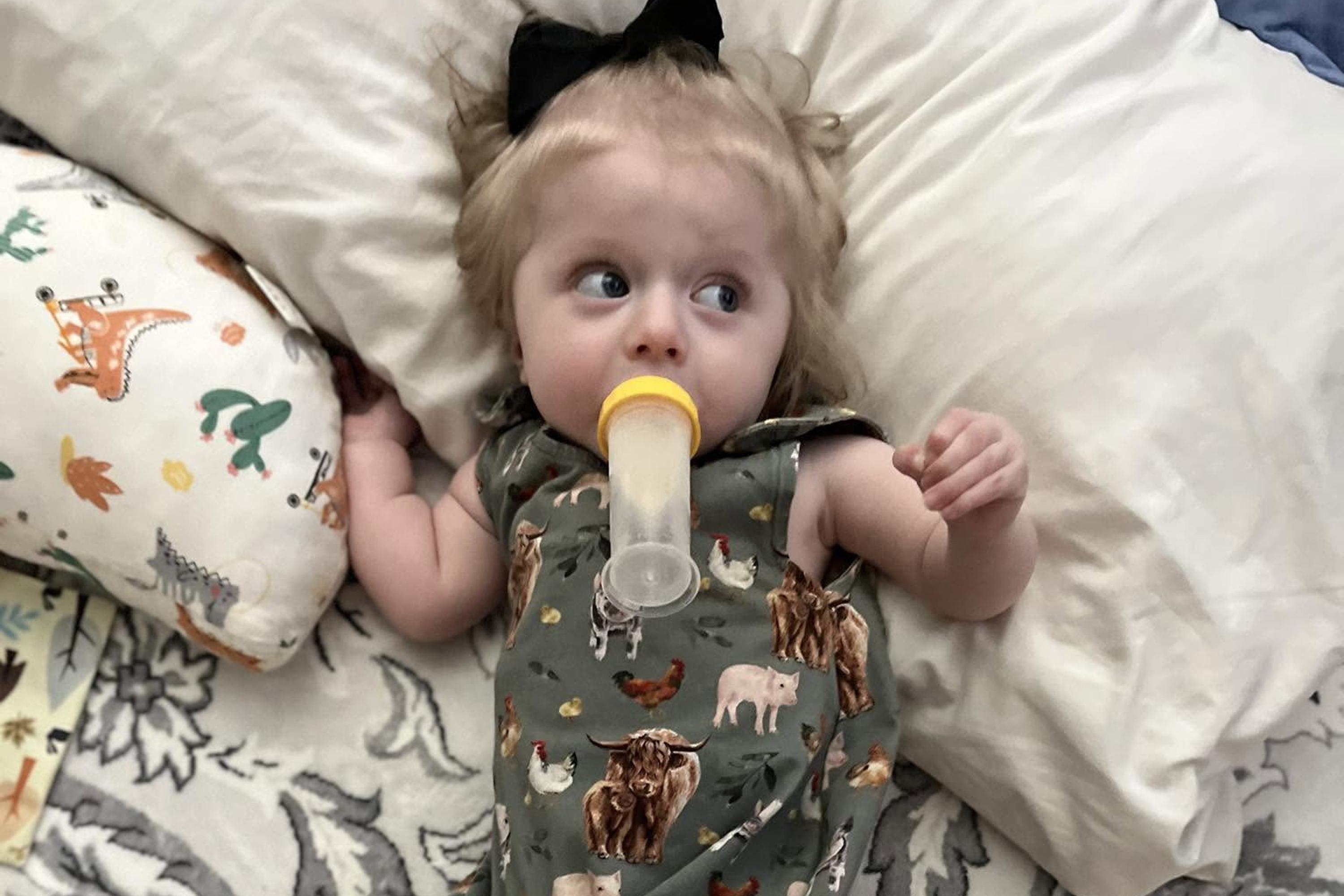Eleanor Butler Alexander Brittle but Brave: Baldwin County toddler to undergo extensive surgery ...