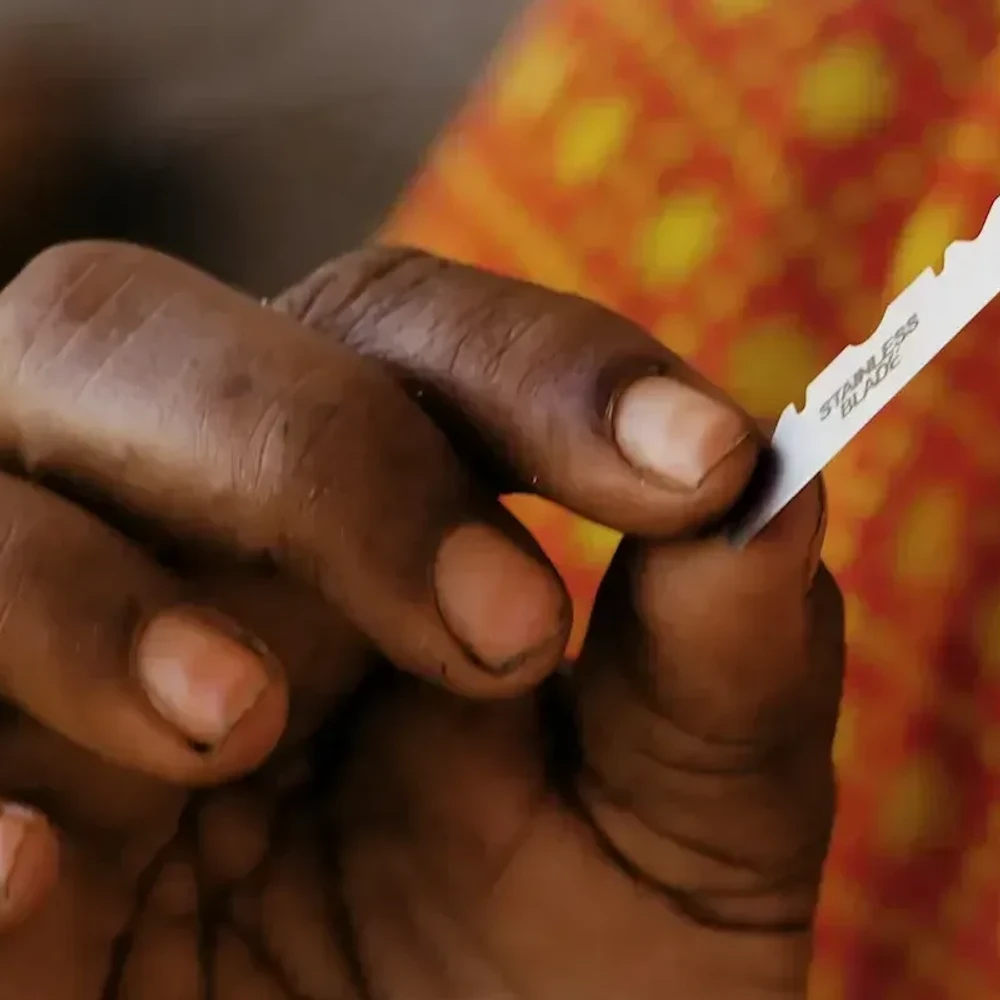 Razor, female genital mutilation Alabama News