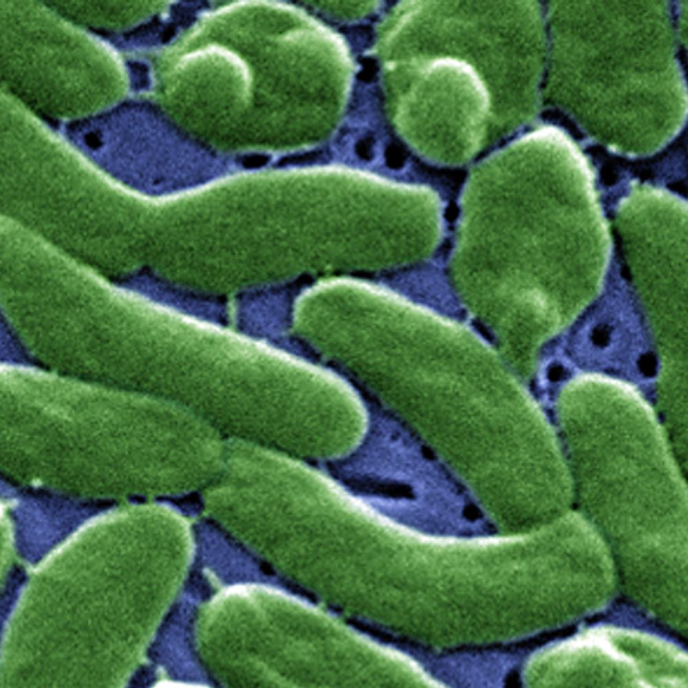 Vibrio Vulnificus Alabama News