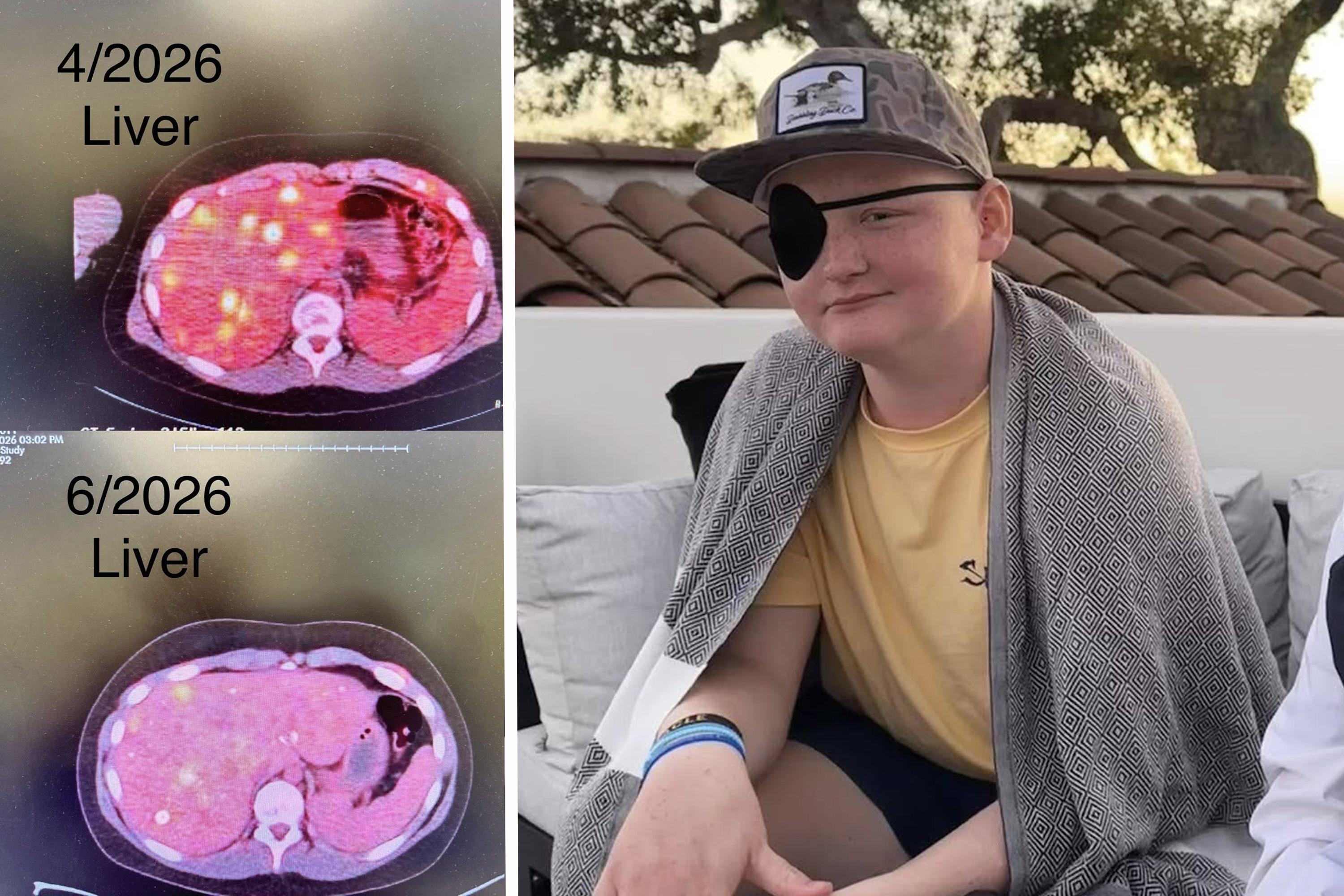 God is bigger': Will Roberts shares incredible cancer journey update