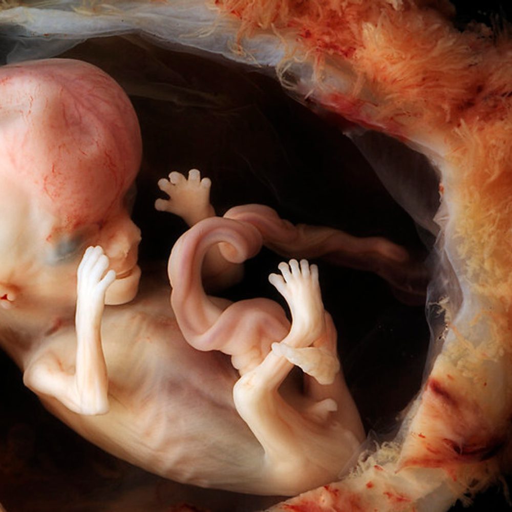 Alabama political news baby womb Alabama News
