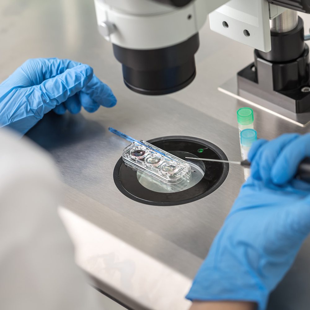 in-vitro fertilization, ivf Alabama News