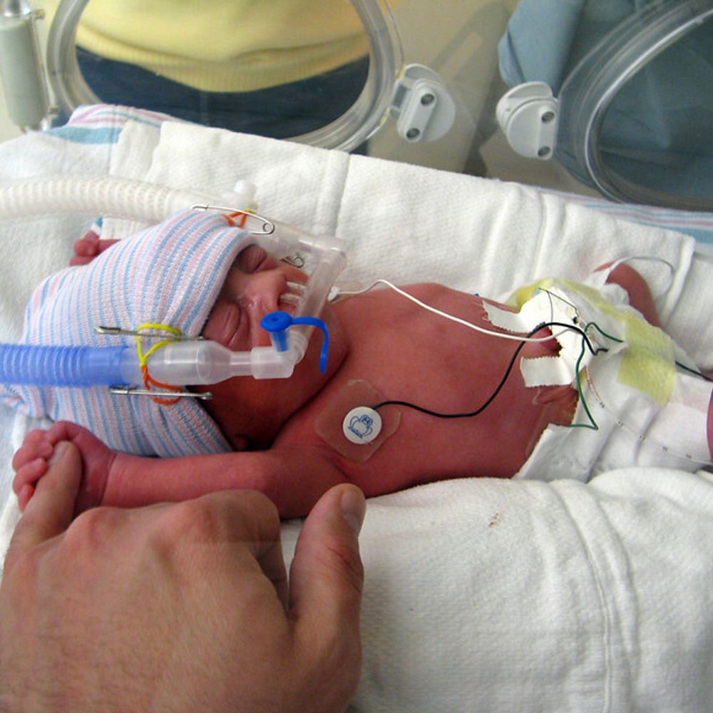 Alabama political news premature baby Alabama News