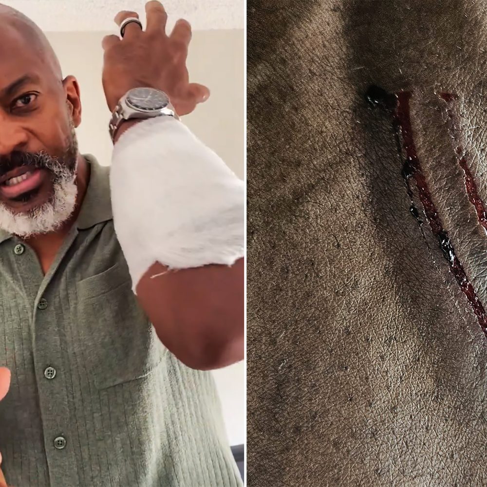 billy ray todd attacked Alabama News