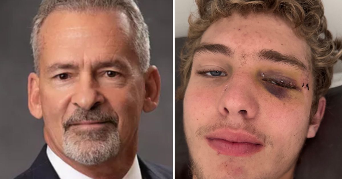 Madison County DA defends decision not to press charges in injured