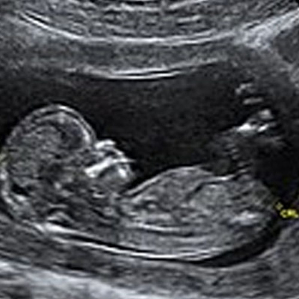 File caf3229e ecd8 4235 9e2a eabc3f6b884b Alabama News