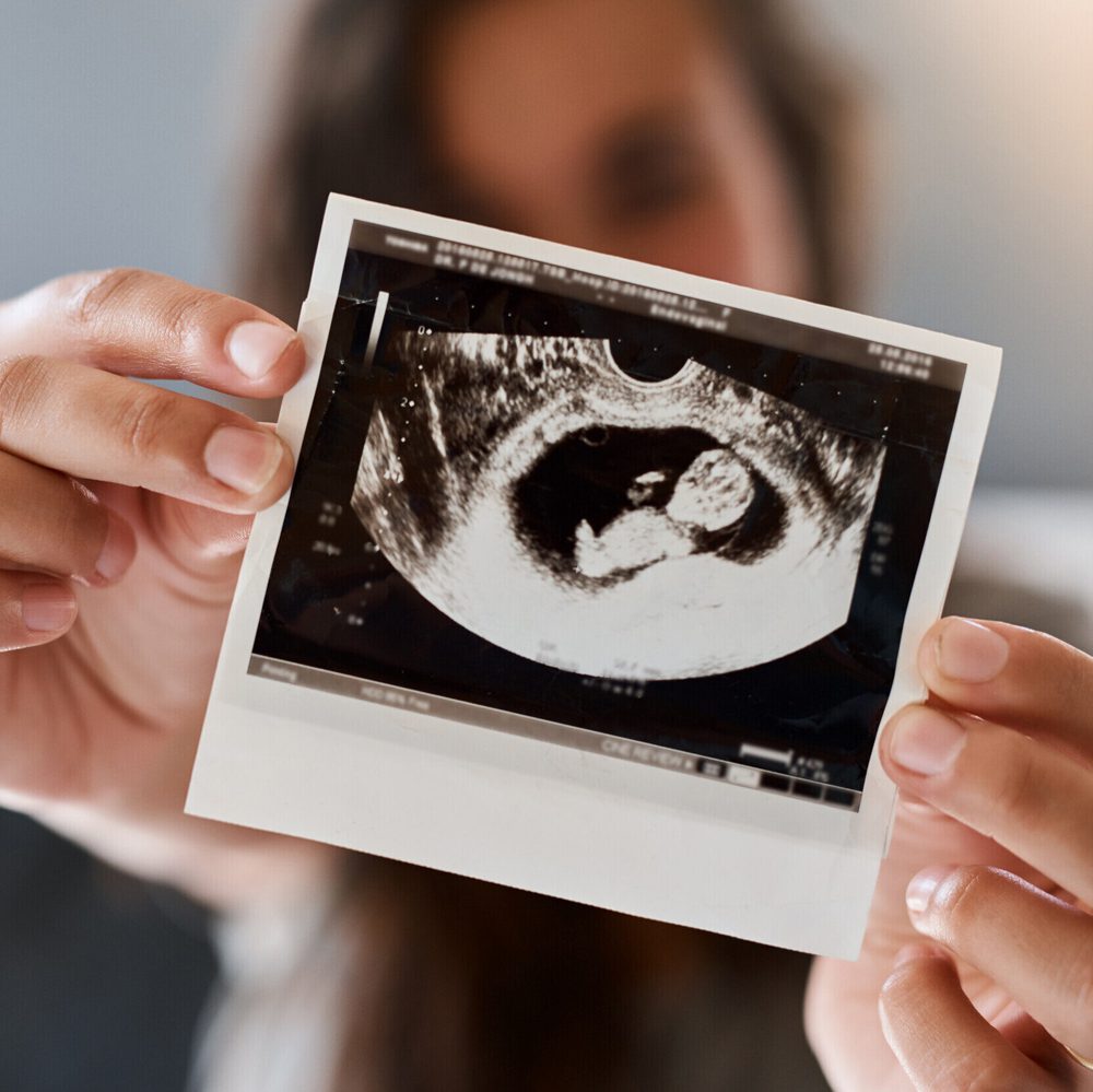 Ultrasound Alabama News