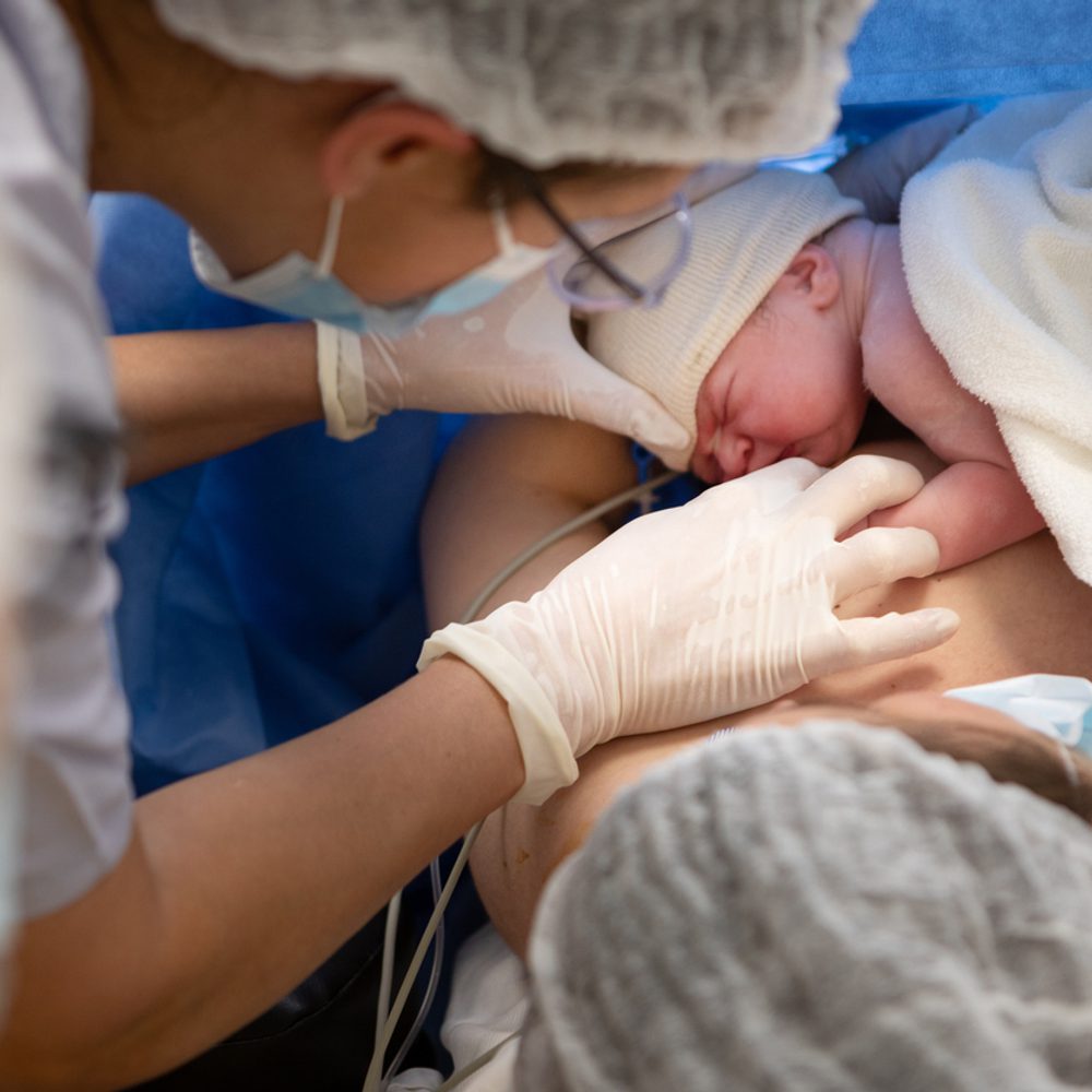 Mother breastfeeds her newborn baby after a cesarean section stock photo, midwife Alabama News