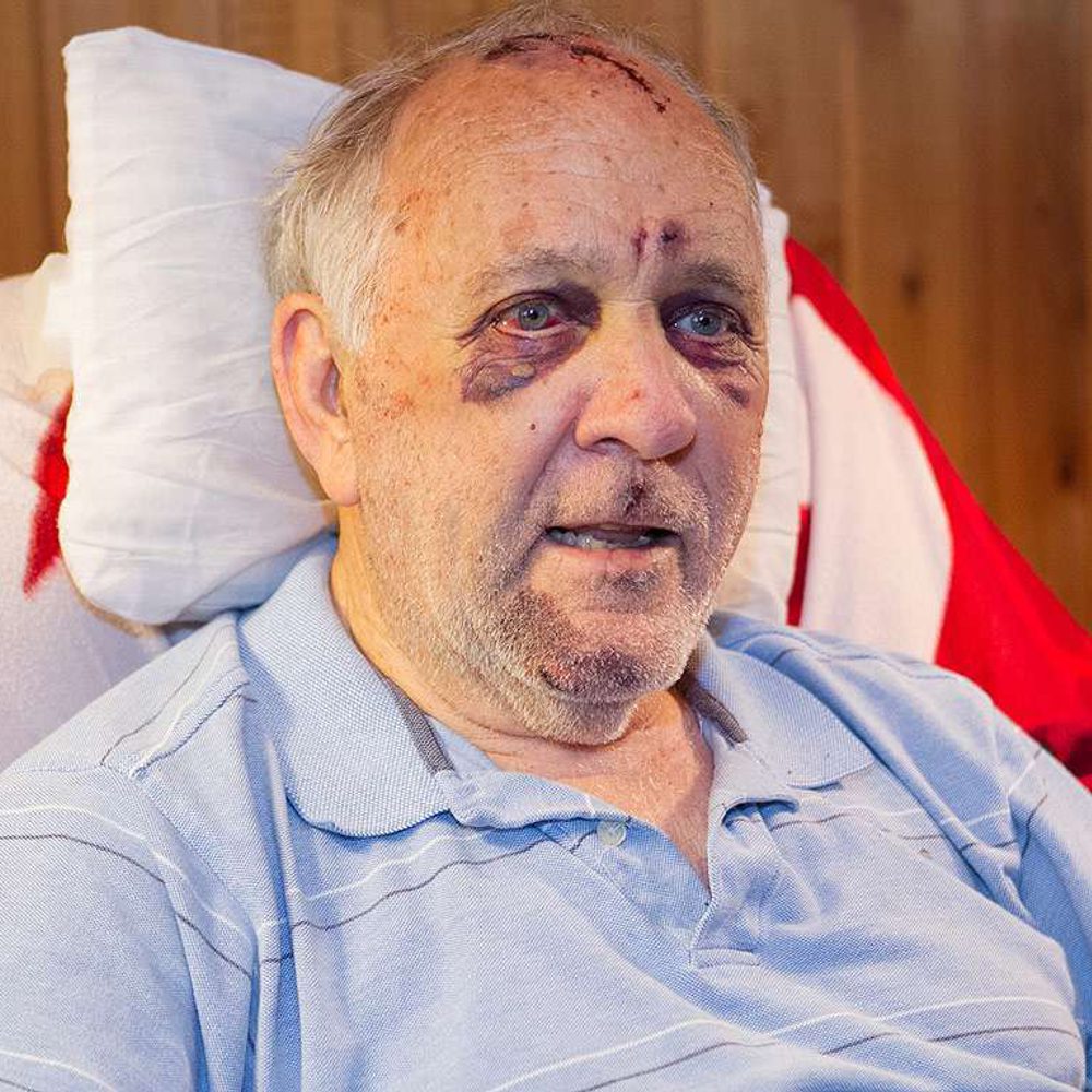 Larrybartoninjured Alabama News
